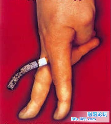 吸烟会导致阳痿.jpg